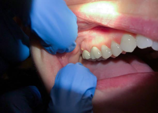 Best Pediatric Emergency Dentist in North Windham, ME