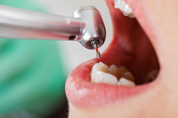 Best Walk-In Emergency Dentist in North Windham, ME